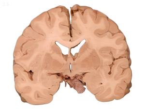 Brain Slice Pendant