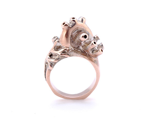 Vascular Ring